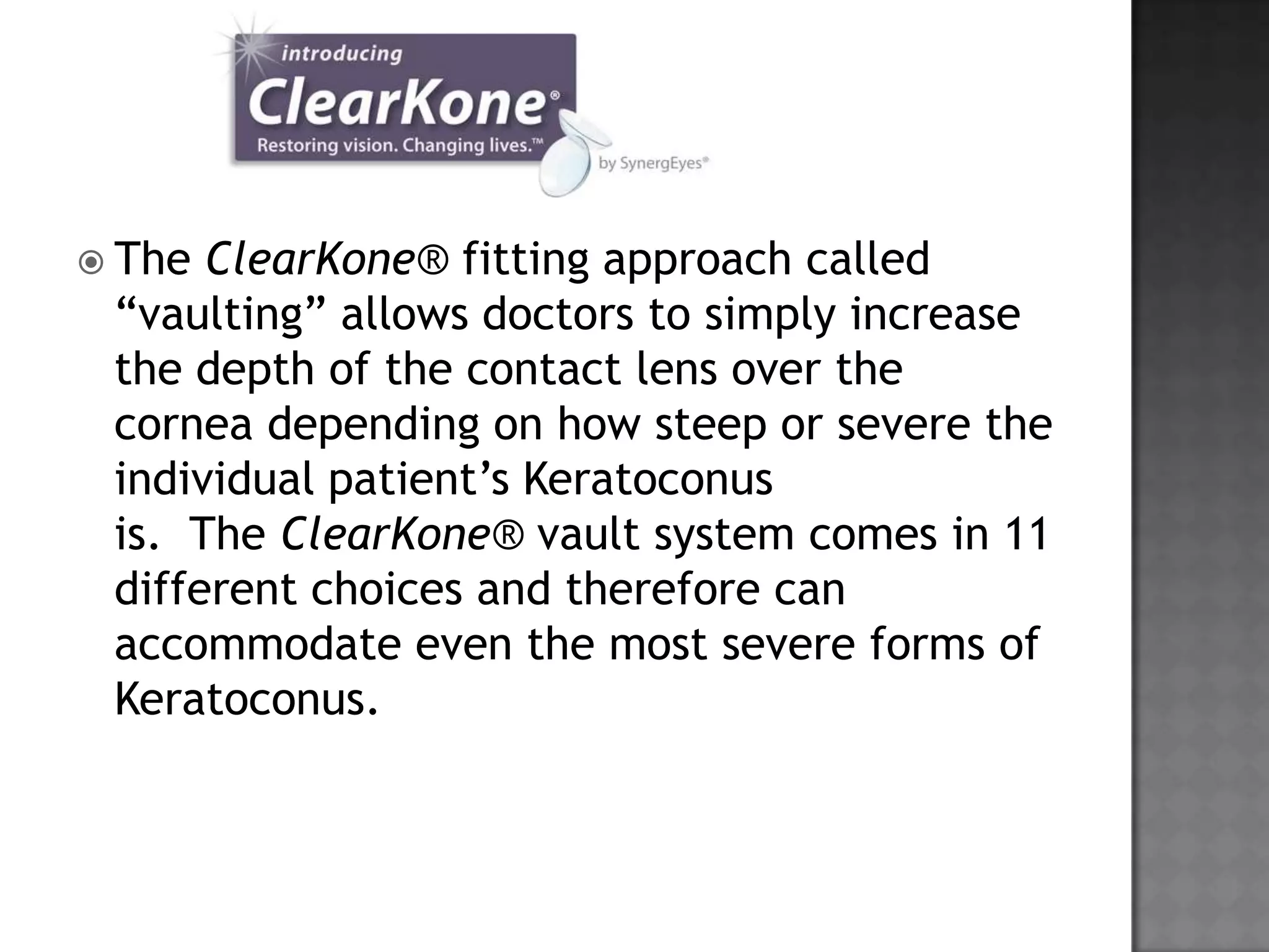  The ClearKone® fitting approach called
“vaulting” allows doctors to simply increase
the depth of the contact lens over the
cornea depending on how steep or severe the
individual patient’s Keratoconus
is. The ClearKone® vault system comes in 11
different choices and therefore can
accommodate even the most severe forms of
Keratoconus.
 