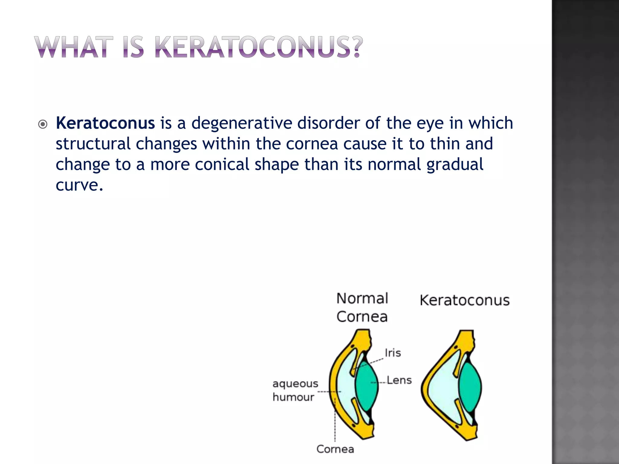 Keratoconus is a degenerative disorder of the eye in which
structural changes within the cornea cause it to thin and
change to a more conical shape than its normal gradual
curve.
 