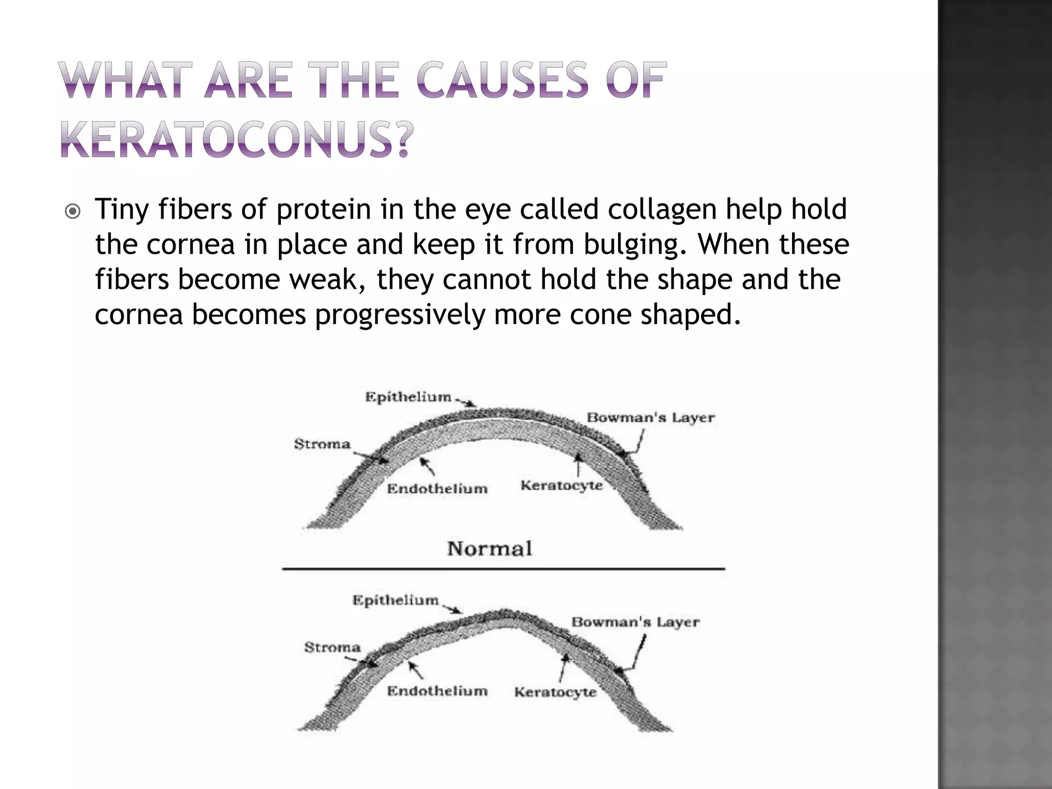  Tiny fibers of protein in the eye called collagen help hold
the cornea in place and keep it from bulging. When these
fibers become weak, they cannot hold the shape and the
cornea becomes progressively more cone shaped.
 