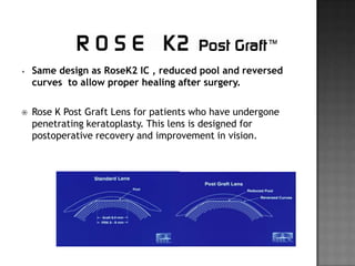Keratoconus managment | PPTX