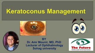 BY
Dr. Amr Mounir, MD, PhD
Lecturer of Ophthalmology
Sohag university
 