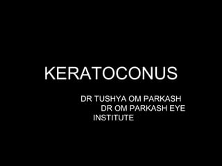 KERATOCONUS
DR TUSHYA OM PARKASH
DR OM PARKASH EYE
INSTITUTE
 