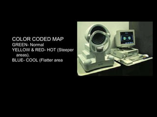 COLOR CODED MAP
GREEN- Normal
YELLOW & RED- HOT (Steeper
areas).
BLUE- COOL (Flatter areas
 
