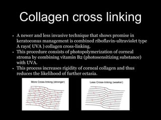 Collagen cross linking
• A newer and less invasive technique that shows promise in
keratoconus management is combined riboflavin-ultraviolet type
A rays( UVA ) collagen cross-linking.
• This procedure consists of photopolymerization of corneal
stroma by combining vitamin B2 (photosensitizing substance)
with UVA.
• This process increases rigidity of corneal collagen and thus
reduces the likelihood of further ectasia.
 