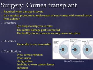 o Required when damage is severe
o It’s a surgical procedure to replace part of your cornea with corneal tissue
from a donor
o Procedure
Eye drops to help you to relax
The central damage part is removed
The healthy donor cornea is securely sewn into place
o Outcomes
Generally is very successful
o Complications
New cornea rejection
Poor vision
Astigmatism
Inability to wear contact lenses
Infection
Surgery: Cornea transplant
Corneal transplantation
 