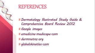 REFERENCES
Dermatology Illustrated Study Guide &
Comprehensive Board Review 2012
Google images
emedicine.medscape.com
dermnetnz.org
globalskinatlas.com
 