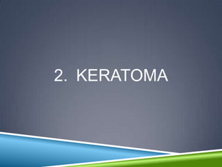 2. KERATOMA
 