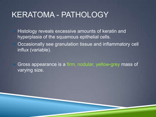 KERATOMA - PATHOLOGY
 Histology reveals excessive amounts of keratin and
  hyperplasia of the squamous epithelial cells.
 Occasionally see granulation tissue and inflammatory cell
  influx (variable).


 Gross appearance is a firm, nodular, yellow-grey mass of
  varying size.
 
