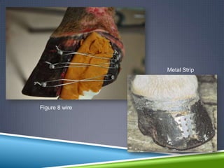 Metal Strip




Figure 8 wire
 