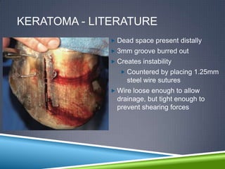 KERATOMA - LITERATURE
              Dead space present distally
              3mm groove burred out
              Creates instability
                 Countered by placing 1.25mm
                  steel wire sutures
              Wire loose enough to allow
               drainage, but tight enough to
               prevent shearing forces
 
