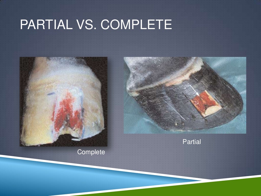 Keratoma, canker, quittor, corn