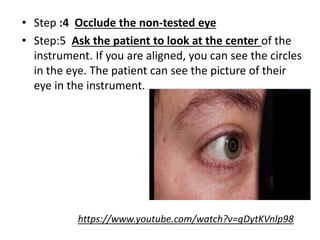 • Step :4 Occlude the non-tested eye
• Step:5 Ask the patient to look at the center of the
instrument. If you are aligned, you can see the circles
in the eye. The patient can see the picture of their
eye in the instrument.
https://www.youtube.com/watch?v=gDytKVnlp98
 