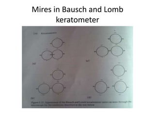 Mires in Bausch and Lomb
keratometer
 