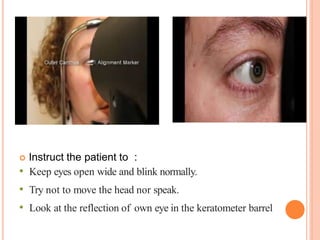  Instruct the patient to :
• Keep eyes open wide and blink normally.
• Try not to move the head nor speak.
• Look at the reflection of own eye in the keratometer barrel
 