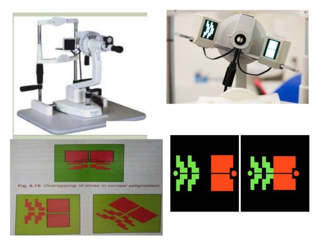 KERATOMETRY AND IOL POWER CALCULATION-1.pptx
