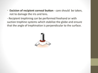 • Excision of recipient corneal button - care should be taken,
not to damage the iris and lens.
- Recipient trephining can be performed freehand or with
suction trephine systems which stabilize the globe and ensure
that the angle of trephination is perpendicular to the surface.
 