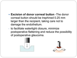  Excision of donor corneal button -The donor
corneal button should be trephined 0.25 mm
larger than the recipient, taking care not to
damage the endothelium.
- to facilitate watertight closure, minimize
postoperative flattening and reduce the possibility
of postoperative glaucoma.
 
