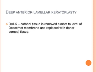 DEEP ANTERIOR LAMELLAR KERATOPLASTY
 DALK – corneal tissue is removed almost to level of
Descemet membrane and replaced with donor
corneal tissue.
 