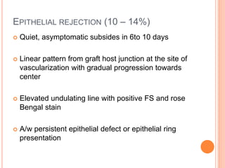 EPITHELIAL REJECTION (10 – 14%)
 Quiet, asymptomatic subsides in 6to 10 days
 Linear pattern from graft host junction at the site of
vascularization with gradual progression towards
center
 Elevated undulating line with positive FS and rose
Bengal stain
 A/w persistent epithelial defect or epithelial ring
presentation
 