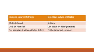 Immune suture infiltrates Infectious suture infiltrates
Multiple/small Solitary
Only on host side Can occur on host/ graft side
Not associated with epithelial defect Epithelial defect common
 