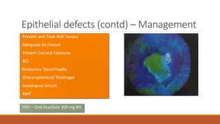 Epithelial defects (contd) – Management
• Prevent and Treat Risk Factors
• Adequate lid closure
• Prevent Corneal Exposure
• BCL
•Temporary Tarsorrhaphy
• Choramphenicol/ Panthogel
• Autologous Serum
• AMT
• HSV – Oral Acyclovir 300 mg BD
 