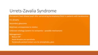 Urrets-Zavalia Syndrome
•Permanent fixed dilated pupil after penetrating keratoplasty/DALK in patients with keratoconus
•Iris atrophy
•Secondary glaucoma
•Mydriasis unresponsive to miotics
•Unknown etiology (severe iris ischaemia – possible mechanism)
•Management –
• Reduce IOP
• Avoid Atropine pre-operatively
• Peripherally painted Contact Lens for photophobia, glare
 