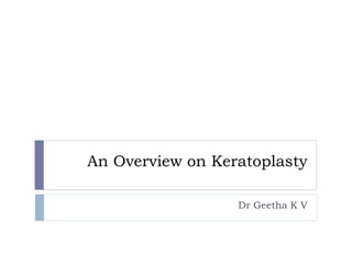 An Overview on Keratoplasty
Dr Geetha K V
 