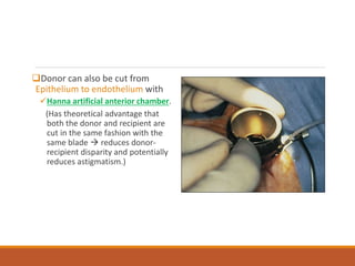 Donor can also be cut from
Epithelium to endothelium with
Hanna artificial anterior chamber.
(Has theoretical advantage that
both the donor and recipient are
cut in the same fashion with the
same blade  reduces donor-
recipient disparity and potentially
reduces astigmatism.)
 