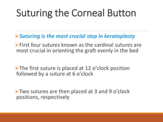 Suturing the Corneal Button
Suturing is the most crucial step in keratoplasty
First four sutures known as the cardinal sutures are
most crucial in orienting the graft evenly in the bed
The first suture is placed at 12 o'clock position
followed by a suture at 6 o'clock
Two sutures are then placed at 3 and 9 o'clock
positions, respectively
 