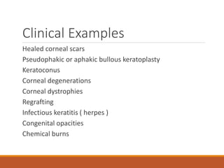 Clinical Examples
Healed corneal scars
Pseudophakic or aphakic bullous keratoplasty
Keratoconus
Corneal degenerations
Corneal dystrophies
Regrafting
Infectious keratitis ( herpes )
Congenital opacities
Chemical burns
 