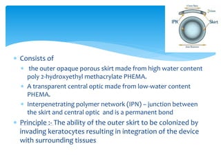  Consists of
 the outer opaque porous skirt made from high water content
poly 2-hydroxyethyl methacrylate PHEMA.
 A transparent central optic made from low-water content
PHEMA.
 Interpenetrating polymer network (IPN) – junction between
the skirt and central optic and is a permanent bond
 Principle :- The ability of the outer skirt to be colonized by
invading keratocytes resulting in integration of the device
with surrounding tissues
 