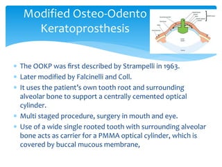  The OOKP was ﬁrst described by Strampelli in 1963.
 Later modified by Falcinelli and Coll.
 It uses the patient’s own tooth root and surrounding
alveolar bone to support a centrally cemented optical
cylinder.
 Multi staged procedure, surgery in mouth and eye.
 Use of a wide single rooted tooth with surrounding alveolar
bone acts as carrier for a PMMA optical cylinder, which is
covered by buccal mucous membrane,
Modified Osteo-Odento
Keratoprosthesis
 