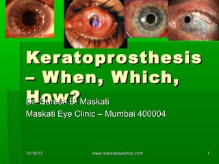 10/10/1310/10/13 www.maskatieyeclinic.comwww.maskatieyeclinic.com 11
KeratoprosthesisKeratoprosthesis
– When, Which,– When, Which,
How?How?Dr. Quresh B. MaskatiDr. Quresh B. Maskati
Maskati Eye Clinic – Mumbai 400004Maskati Eye Clinic – Mumbai 400004
 