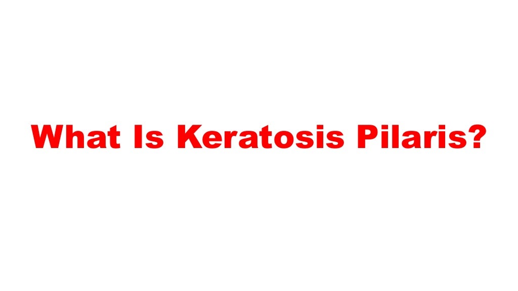 Keratosis pilaris, coconut oil keratosis pilaris, get rid of chicken
