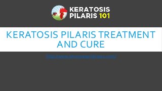 KERATOSIS PILARIS TREATMENT
AND CURE
http://www.keratosispilaris101.com/
 