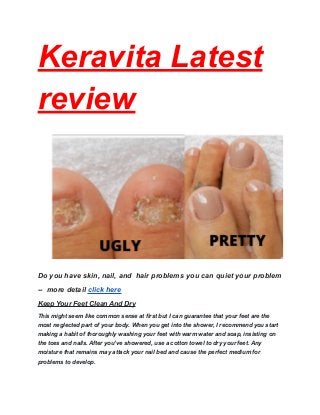 Keravita Latest
review
Do you have skin, nail, and hair problems you can quiet your problem
-- more detail click here
Keep Your Feet Clean And Dry
This might seem like common sense at first but I can guarantee that your feet are the
most neglected part of your body. When you get into the shower, I recommend you start
making a habit of thoroughly washing your feet with warm water and soap, insisting on
the toes and nails. After you’ve showered, use a cotton towel to dry your feet. Any
moisture that remains may attack your nail bed and cause the perfect medium for
problems to develop.
 