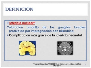 DEFINICIÓN
Ictericia nuclear*
Coloración amarilla de los ganglios basales
producida por impregnación con bilirrubina.
Complicación más grave de la ictericia neonatal.
7
“Neonatal Jaundice” NICE 2010. All rights reserved. Last modified
May 2010
 