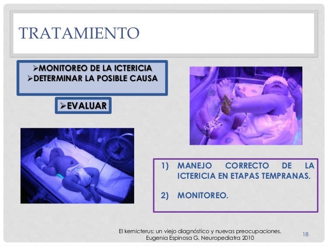 KERNICTERUS TRATAMIENTO EBOOK KERNICTERUS TRATAMIENTO EBOOK