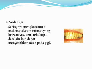 2. Noda Gigi
Seringnya mengkonsumsi
makanan dan minuman yang
berwarna seperti teh, kopi,
dan lain-lain dapat
menyebabkan noda pada gigi.
 