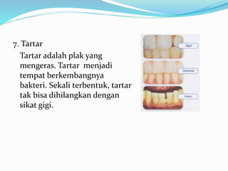 7. Tartar
Tartar adalah plak yang
mengeras. Tartar menjadi
tempat berkembangnya
bakteri. Sekali terbentuk, tartar
tak bisa dihilangkan dengan
sikat gigi.
 