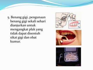 5. Benang gigi, pengunaan
benang gigi sekali sehari
dianjurkan untuk
mengangkat plak yang
tidak dapat disentuh
sikat gigi dan obat
kumur.
 
