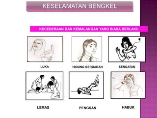 KESELAMATAN BENGKEL
KECEDERAAN DAN KEMALANGAN YANG BIASA BERLAKU
SENGATANHIDUNG BERDARAHLUKA
PENGSAN HABUKLEMAS
 