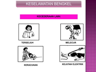 KESELAMATAN BENGKEL
KECEDERAAN LAIN:
TERSELIUH MELECUR
KERACUNAN KEJUTAN ELEKTRIK
 