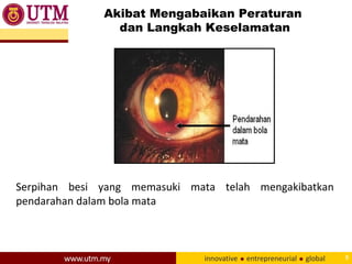 Akibat Mengabaikan Peraturan
dan Langkah Keselamatan
8
Serpihan besi yang memasuki mata telah mengakibatkan
pendarahan dalam bola mata
 