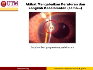 Akibat Mengabaikan Peraturan dan
Langkah Keselamatan (samb…)
9
Serpihan besi yang melekat pada kornea
 