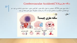 ‫مغزی‬ ‫سکته‬
(
CVA
)
Cerebrovascular Accident
•
‫حادثه‬
‫عروق‬
‫مغزی‬
(
CVA
)
،
‫همچنین‬
‫به‬
‫عنوان‬
‫سکته‬
‫مغزی‬
،
‫انفارکتوس‬
‫مغزی‬
،
‫حمله‬
‫مغزی‬
‫شناخته‬
‫می‬
‫شود‬
،
‫هر‬
‫نوع‬
‫ناهنجاری‬
‫عملکردی‬
‫یا‬
‫ساختاری‬
‫مغز‬
‫است‬
‫که‬
‫در‬
‫اثر‬
‫وضعیت‬
‫پاتولوژیک‬
‫عروق‬
‫مغزی‬
‫ایجاد‬
‫می‬
‫شود‬
.
•
‫علل‬
:
37
 