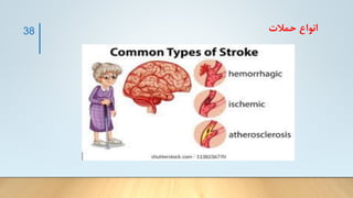 ‫حمالت‬ ‫انواع‬
38
 