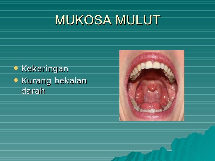Kesihatan pergigian warga emas