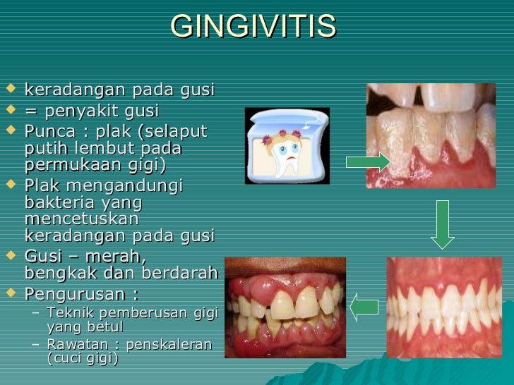 Kesihatan pergigian warga emas