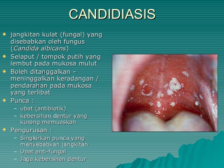 Kesihatan pergigian warga emas